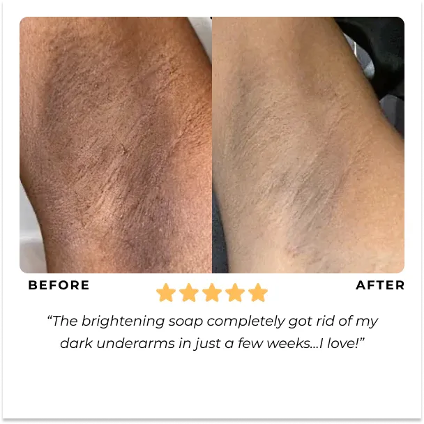 Turmibar - Turmeric Anti-Spots & Hyperpigmentation Soap Bar