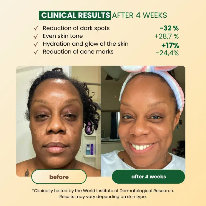 Turmibar - Turmeric Anti-Spots & Hyperpigmentation Soap Bar